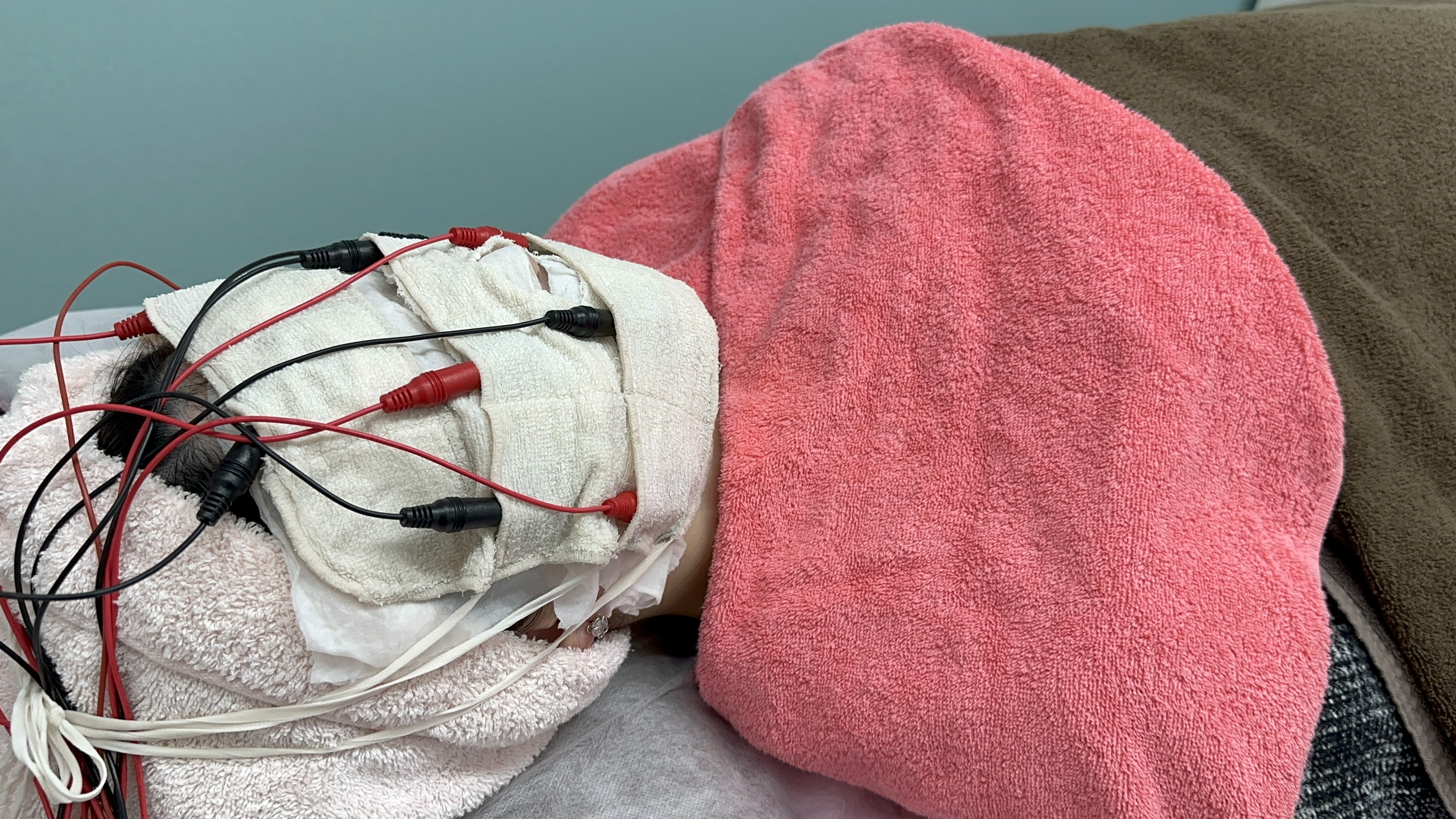 岡山マリアクリニックのイオン導入・バイオニックセルサーの様子