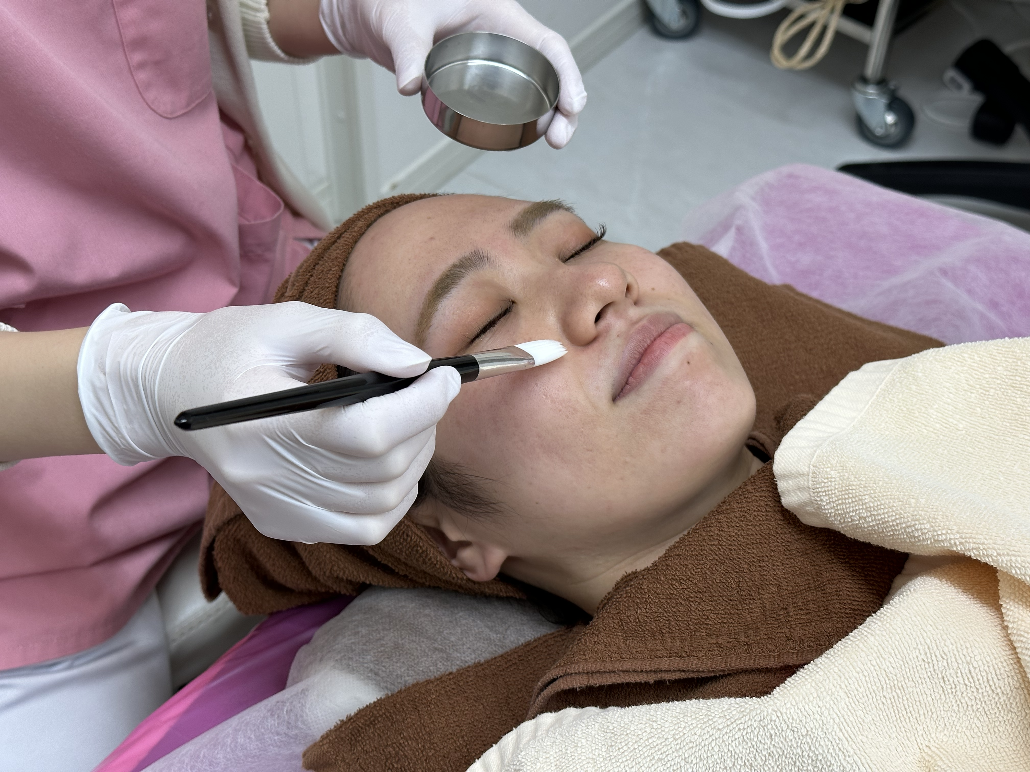 ケミカルピーリングは、薬剤を使ったスキンケア治療